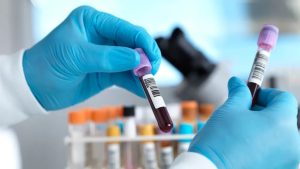 Inggris di Jalur Terdepan untuk Membasmi Hepatitis C